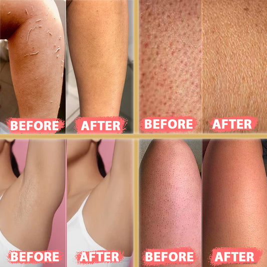 (2 Stück grob) Kelebek Premium Natürliche Peelinghandschuhe, Türkisches Hammam Kese, Original Peelinghandschuh, Körperpeeling für Männer und Frauen 